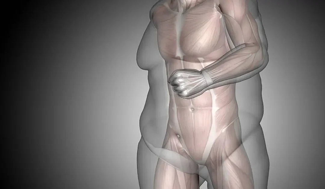 4 moyens de maintenir sa masse musculaire après une chirurgie bariatrique